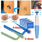 Авто полоса кожу средство удаления бирок Наборы по уходу за кожей лица Красота инструменты для борьбы с акне, прыщей, инструмент для удаления драпировки с 10 шт. резиновые ленты