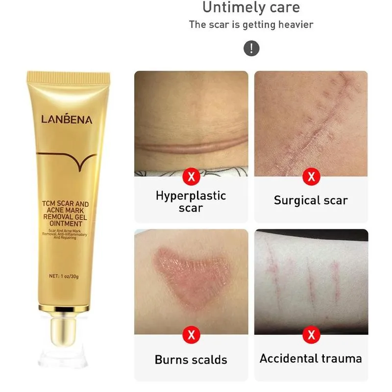 

Acne and scar cream whitening cream gel ointment effectively repair stretch marks and scar skin care 30g