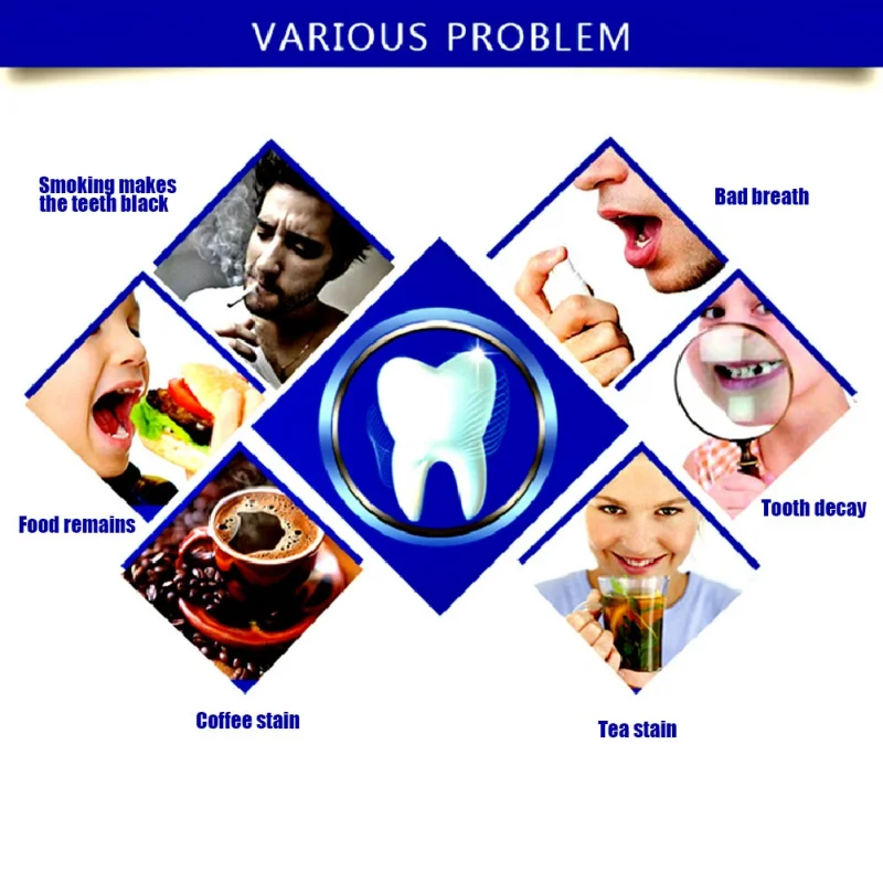50 г отбеливание зубов ослепительный яркий стоматологический гигиена ротовой