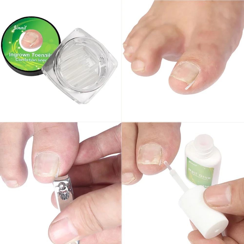 

Nail Care Hook File Clean Tool 1 Set Flexible Pedicure Tools Ingrown Toe Nails Correction Elastic Patches Pad