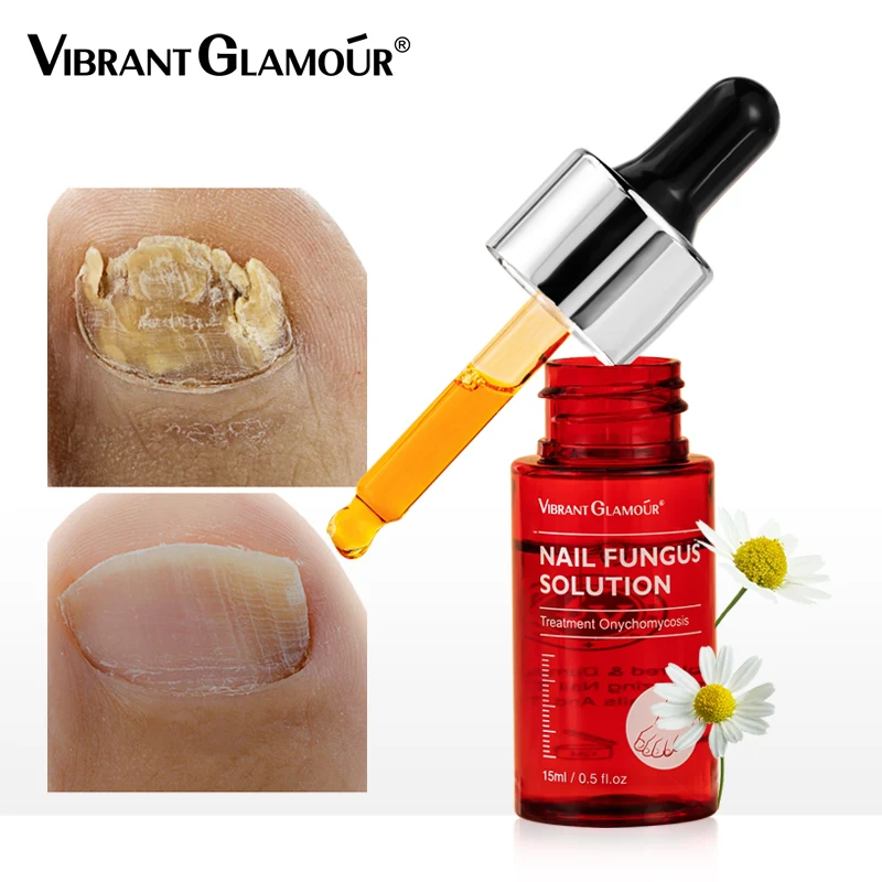 

VIBRANT GLAMOUR Nail Repair Serum Fungus Onychomycosis Treatment Essence Removal Anti Fungus Nail Toe Nourishing Care 15ML