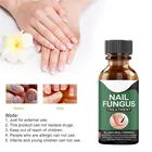 Быстрое лечение ногтей от грибка, восстановление ногтей, эссенции, сыворотка, лечение ногтевого грибка, гель для удаления паронихии и онихомикоза