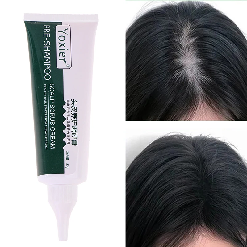 

Скраб для кожи головы Pre-Shampoo для удаления перхоти, фолликулита, лечения выпадения волос