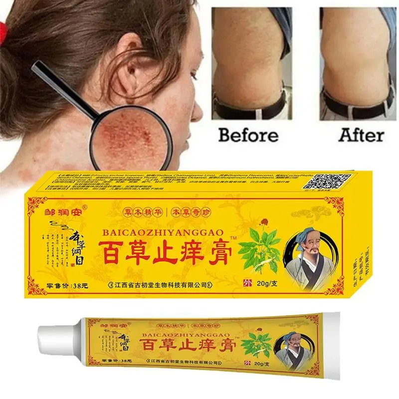 

1Pcs Eczema Psoriasis Antibacterial Treatment Ointment Chinese Natural Medicine Herbal Cream Pruritus Skin Problems Care Skin