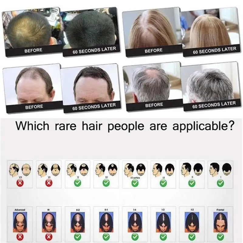 

Keratin Hair Fibers Topic Spray Applicator 27.5g Colorful Powder For Hair Loss Beauty Building Hairline Optimizer Dense Growth