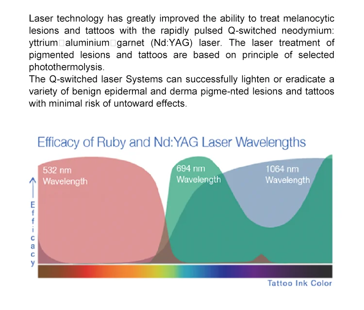 Лазерное удаление татуировок Lutron q лазерное |