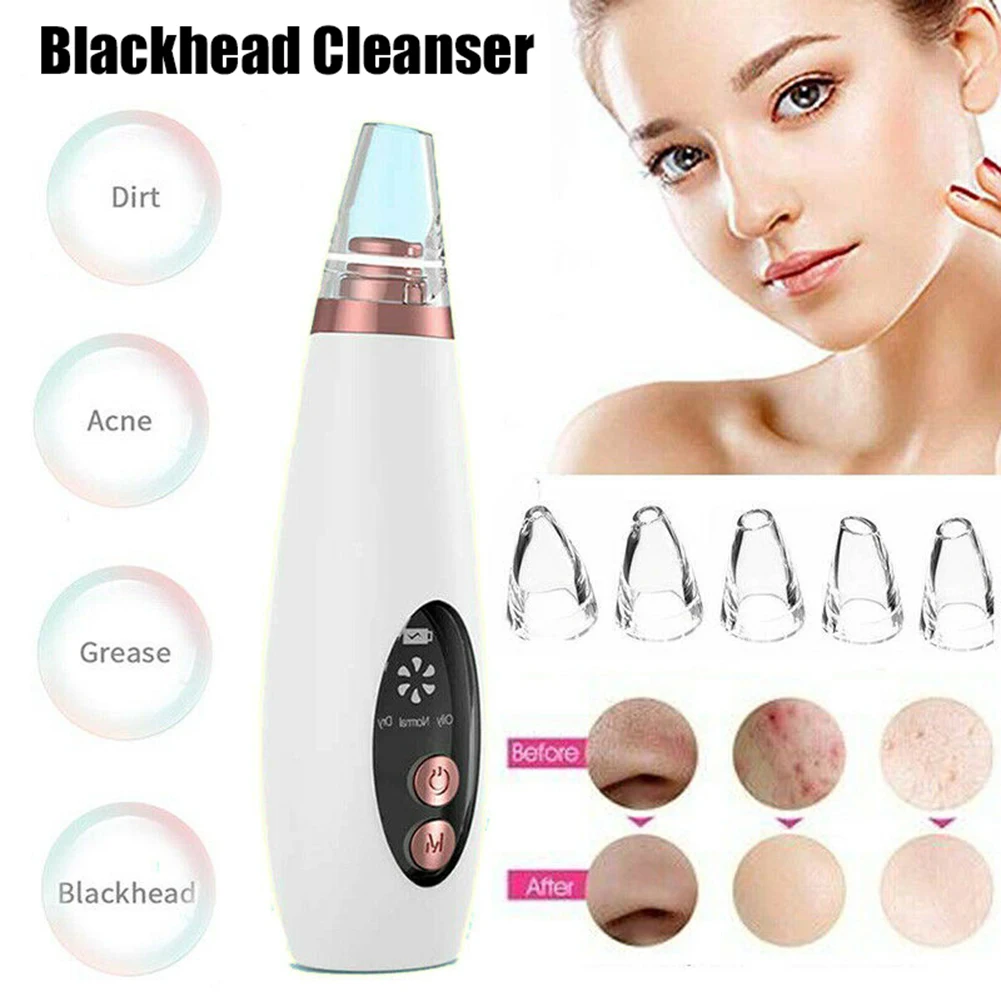 

Wholesale 6 in 1 Electric Blackhead Remover Facial Skin Pore Cleaner Vacuum Acne Cleanser Beauty M3