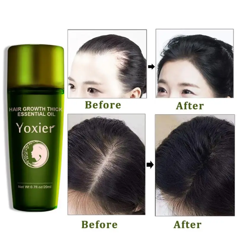 Herbal Hair Treatment Repair root Care Essence Effective Fast Growth Oil Natural Anti hair loss TSLM1 | Красота и здоровье