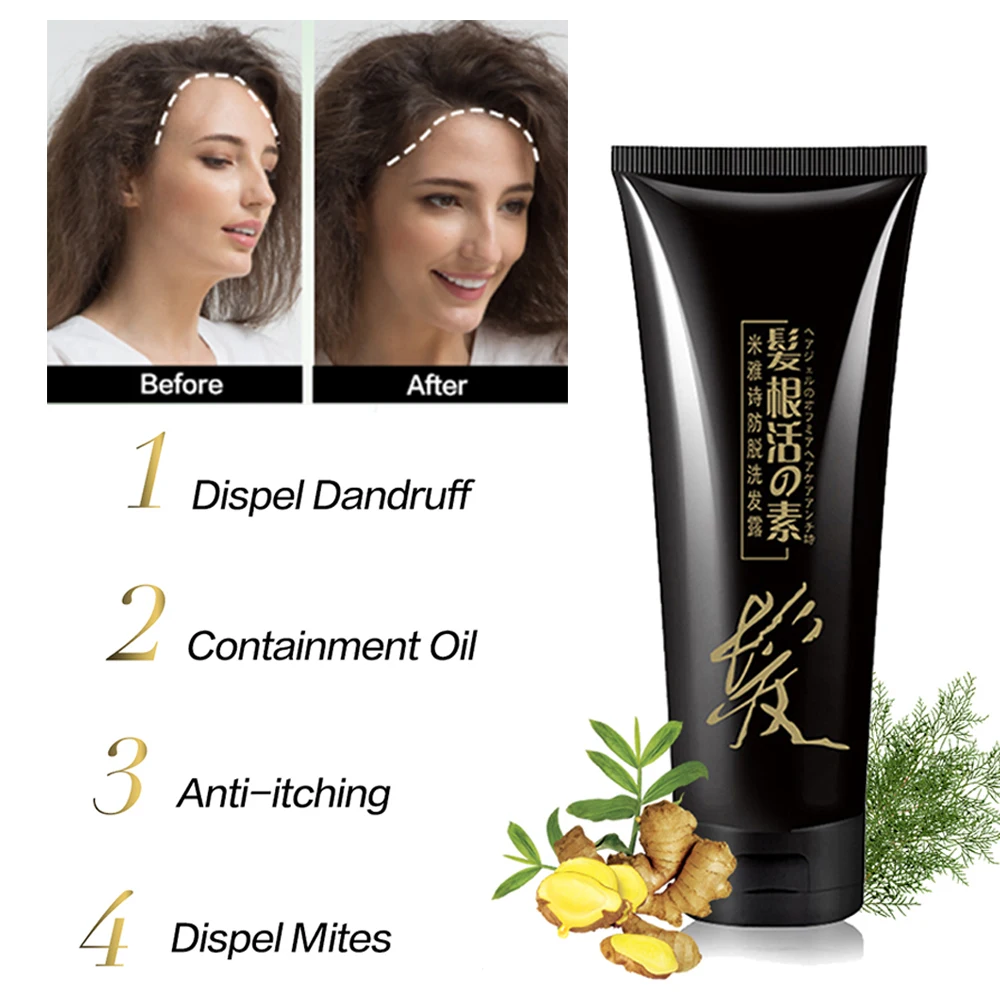 Шампунь для роста волос против выпадения кондиционер мужчин/женщин и мужчин уход