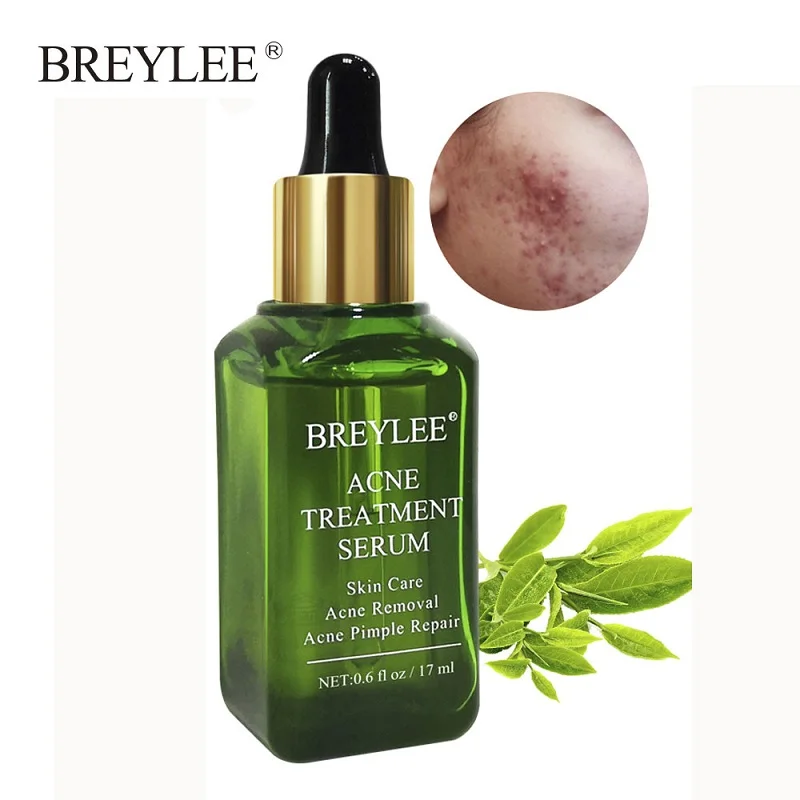 

BREYLEE Acne Treatment Face Serum Essence Anti Acne Pimples Spots Scar Remover Soothing Liquid Moisturizing Whitening Skin Care