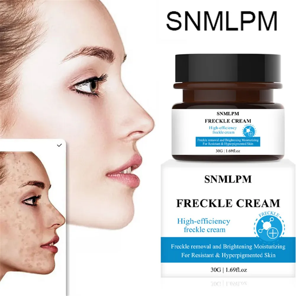 

Whitening Freckle Cream Fade Dark Spots Acne Scar Melanin Pigmentation Melasma Moisturizing Brighten Skin Tone Face Cream 30g