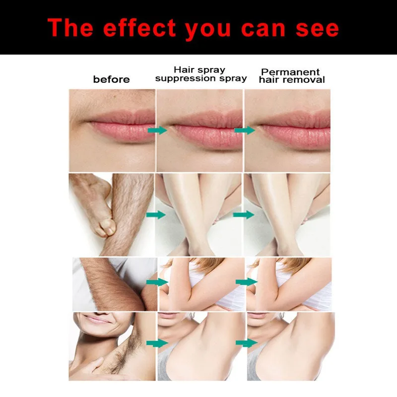 Мягкое не раздражающее удаление волос спрей для ног руки Личная часть тела