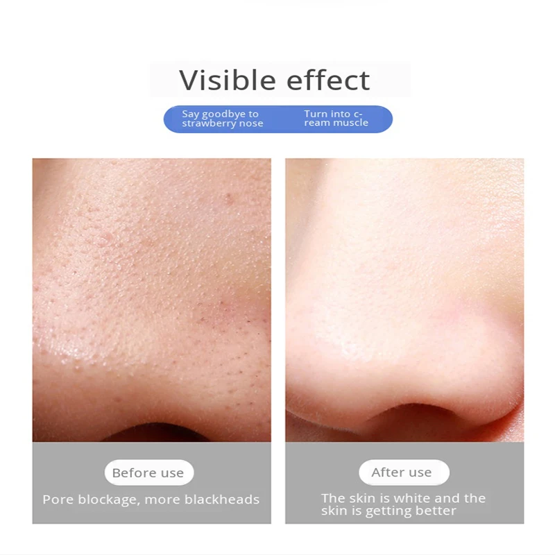 Вакуумный прибор для чистки пор с USB зарядкой 500 раз увеличения|Устройство ухода