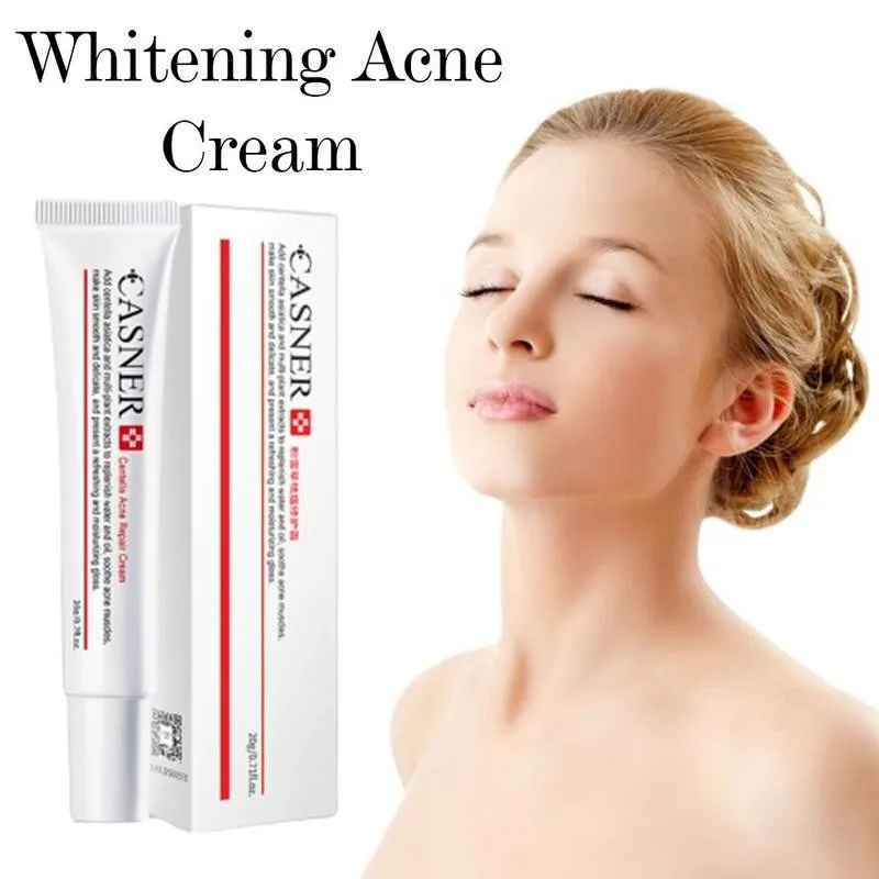 20 мл Крем для удаления пятен лечение акне прыщи шрамы Mark укрепляющий крем ухода