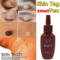 20ml skin tag remover 12 hours medical kill remover skin tag mole genital wart remover foot corn removal