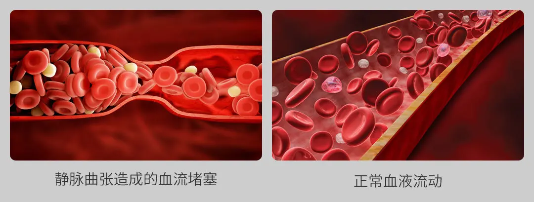 2019Xiao mi jia Lefan массажер для ног с воздушным давлением, способствует объемному воздействию крови на ногу, 3-мерная кривая Xio mi для красоты и здоровья