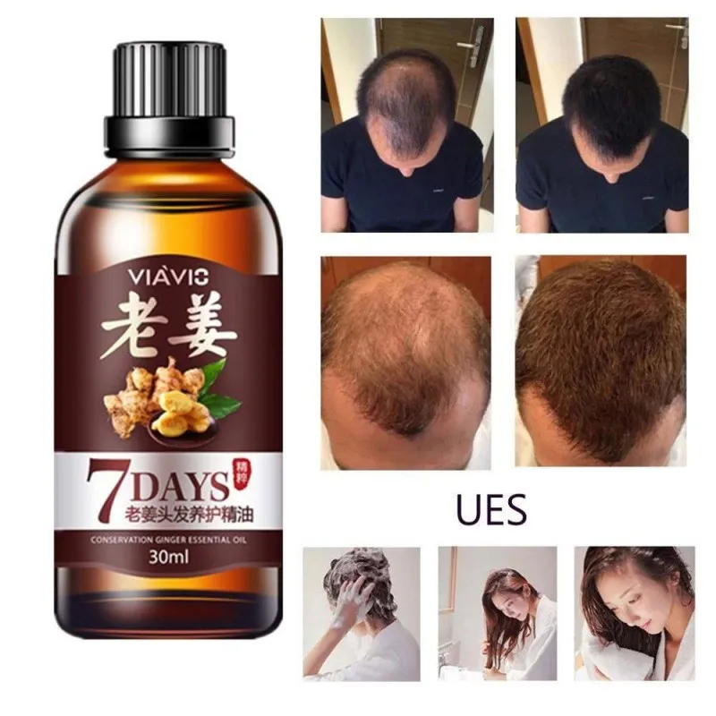 Быстрый рост волос плотная отрастания имбирь Сыворотки масло против выпадения