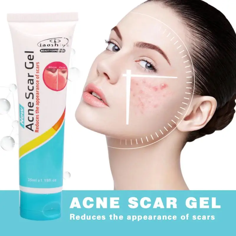 

Effective Acne Removal Cream Herbal Anti-acne Repair Fade Acne Spots Oil Control Whitening Moisturizing Face Gel Skin Care 35ml