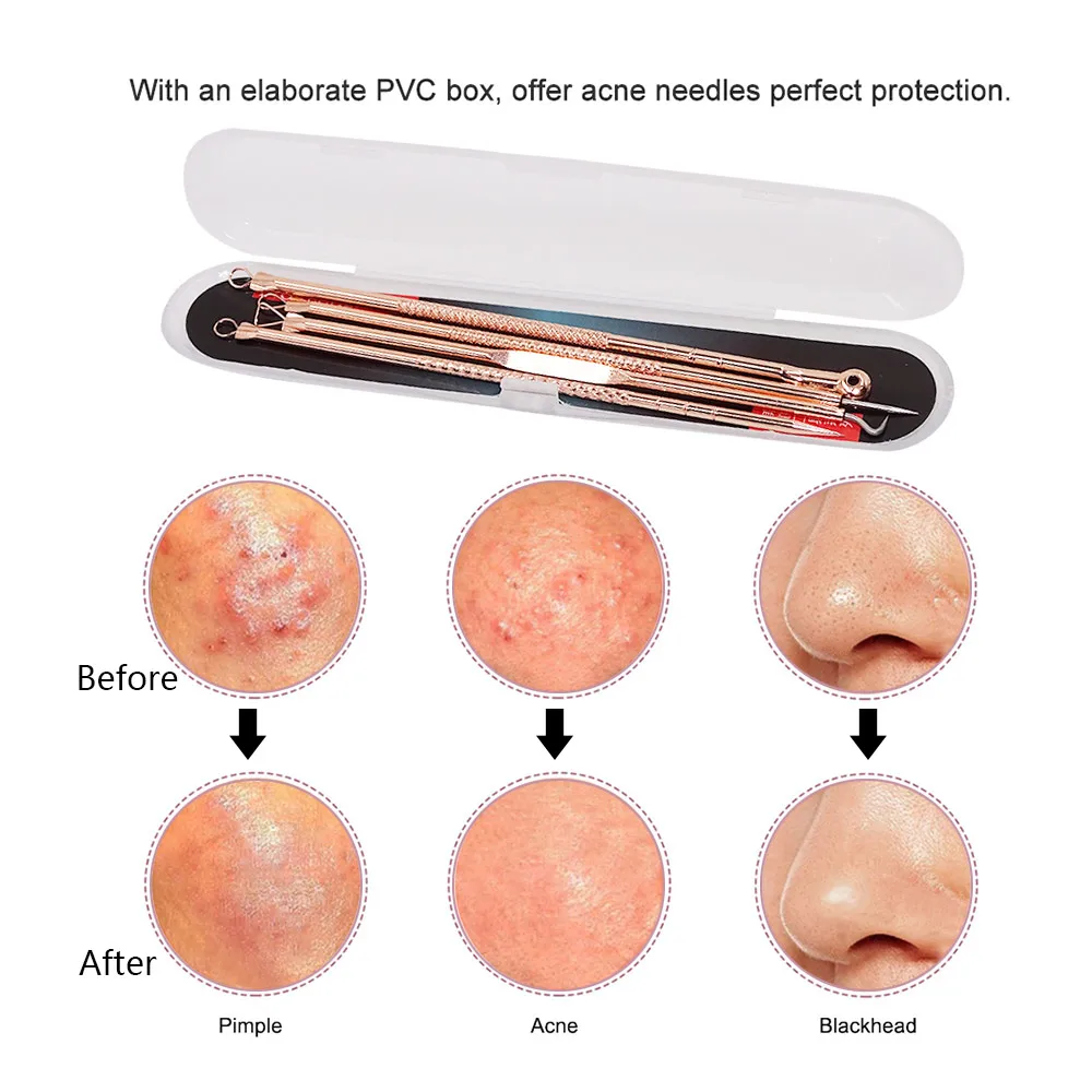 

Visible Acne Blackhead Remover Pore Pimple Vacuum Black Head Suction Nose Deep Cleaner Facial Skin Care Beauty Rechargeable