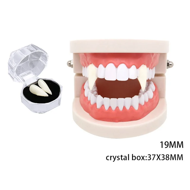 бюгельный протез кламмер роуча. протез на клык. припасовка цельнолитого мостовидного протеза. бюгельный протез на кламмерах (1 челюсть). протез на клык.