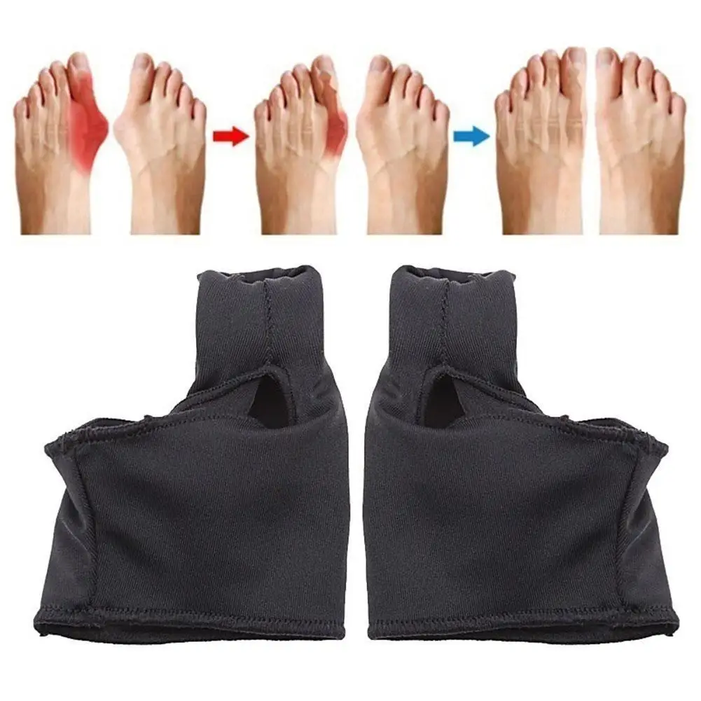 

1 пара исправление вальгусной деформации первого пальца стопы подтяжки большого пальца стопы ортопедической коррекции снять средство по у...