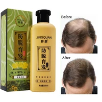 ginger hair shampoo prevent hair loss oil control chute de cheveux tratamento anti dandruff antipruritic refresh regrowth 235ml