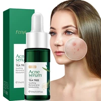 face anti acne serum removes acne marks repairs nourishment moisturizing anti aging oil control shrinking pores skin care 17ml