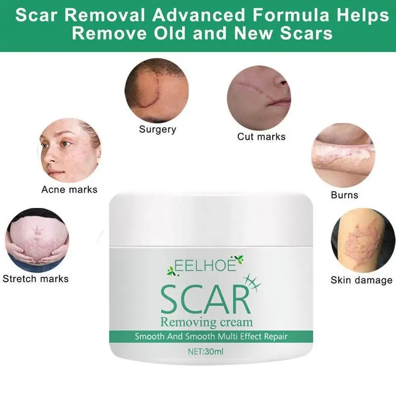 30ML Acne Scar Removal Cream Repair Acne Spots Acne Treatment Blackhead Whitening Shrink Pores Stretch Marks Skin Care