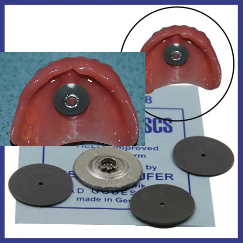 1 набор стоматологических материалов стоматологическая присоска удержание