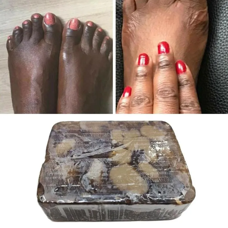 

Африканское черное мыло, 100% чистое неочищенное лечение акне, мыло с растяжкой, натуральное волшебное Косметическое Мыло против пятен