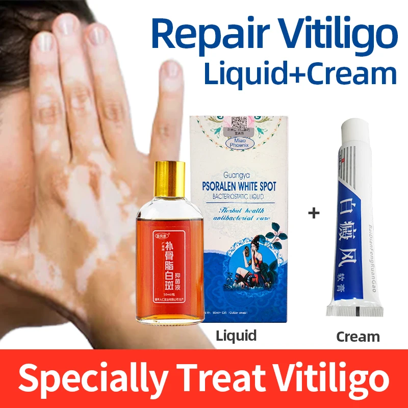 

Vitiligo Antibacterial Spray Treatment Skin Sweat Spots Leukoplakia Piebald Disease Promoting Pigment Healthy Care Solution