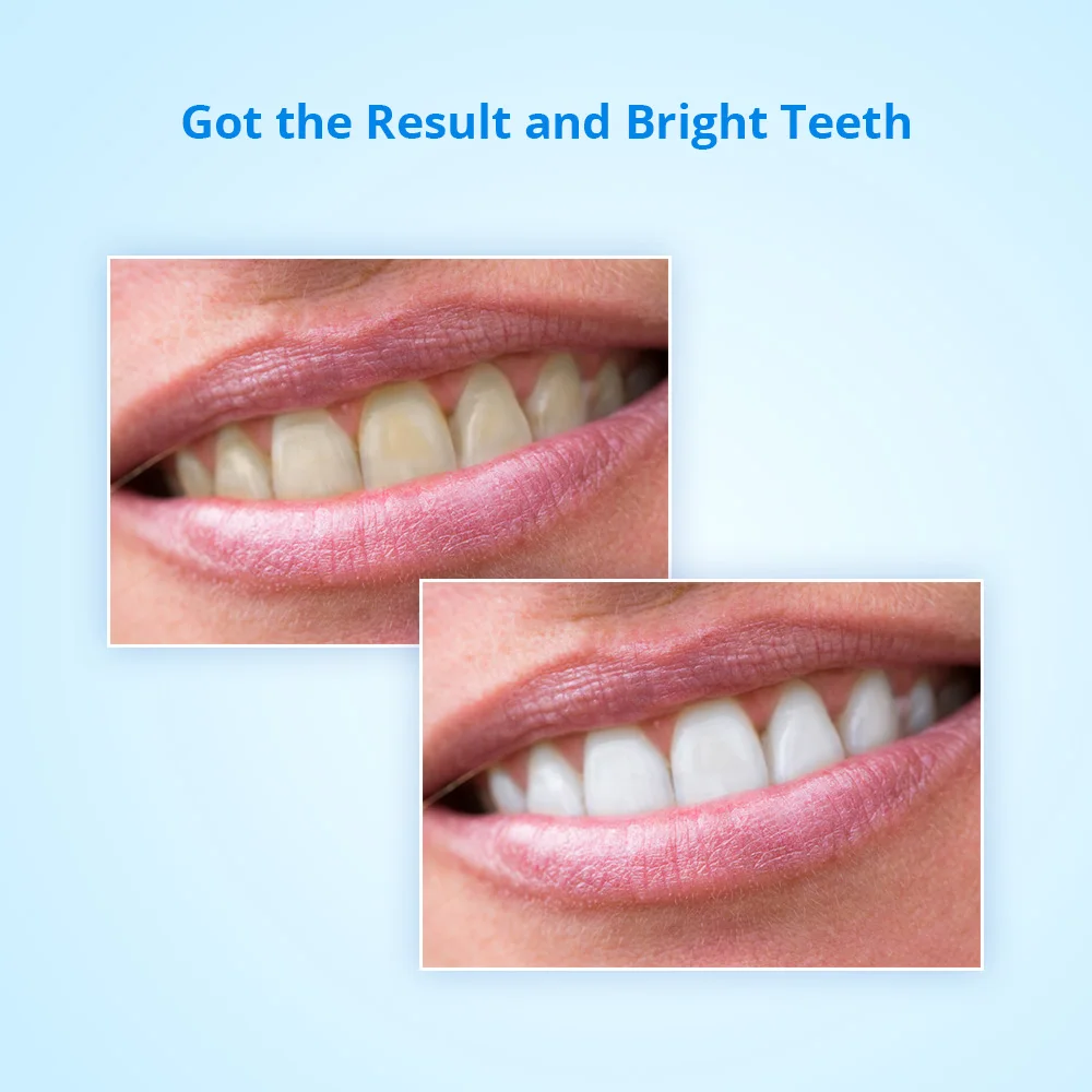 Система для отбеливания зубов Ge 4 мл с низкой чувствительностью домашнего