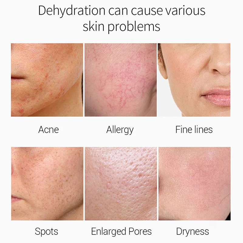 Влажный ремонт эссенция для лица с гиалуроновой кислотой уход за кожей Сыворотки