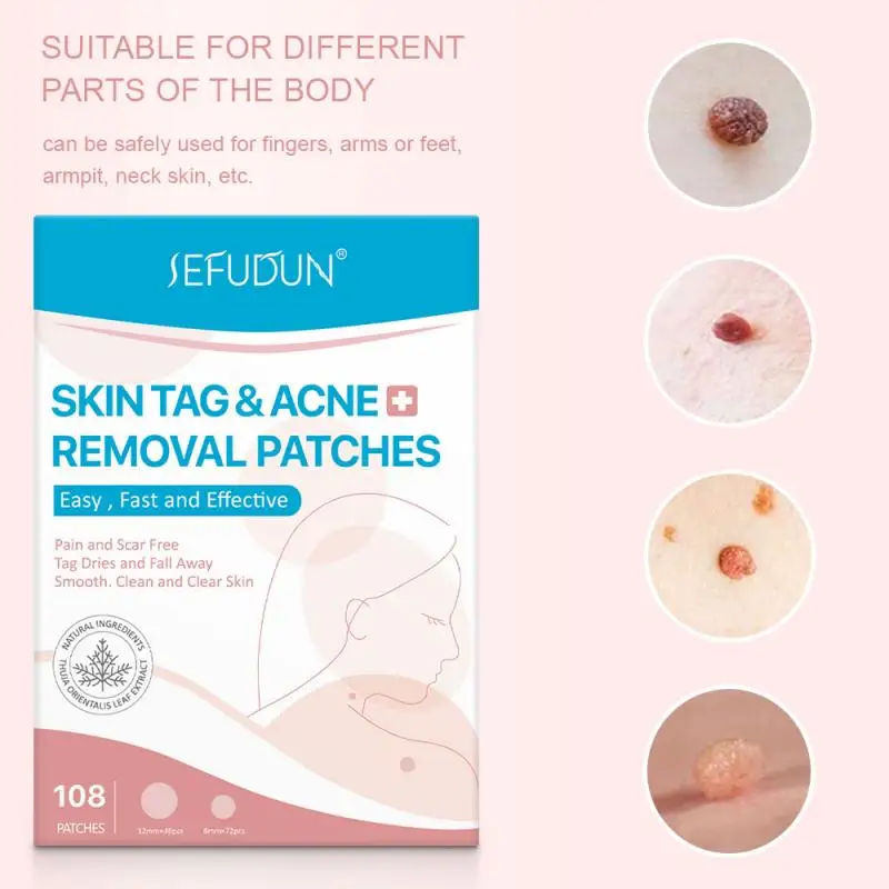 108Pcs Remover Pimple Master Patch Acne Treatment Protects Invisible Face Care Cosmetics Plaster Anti- | Красота и здоровье