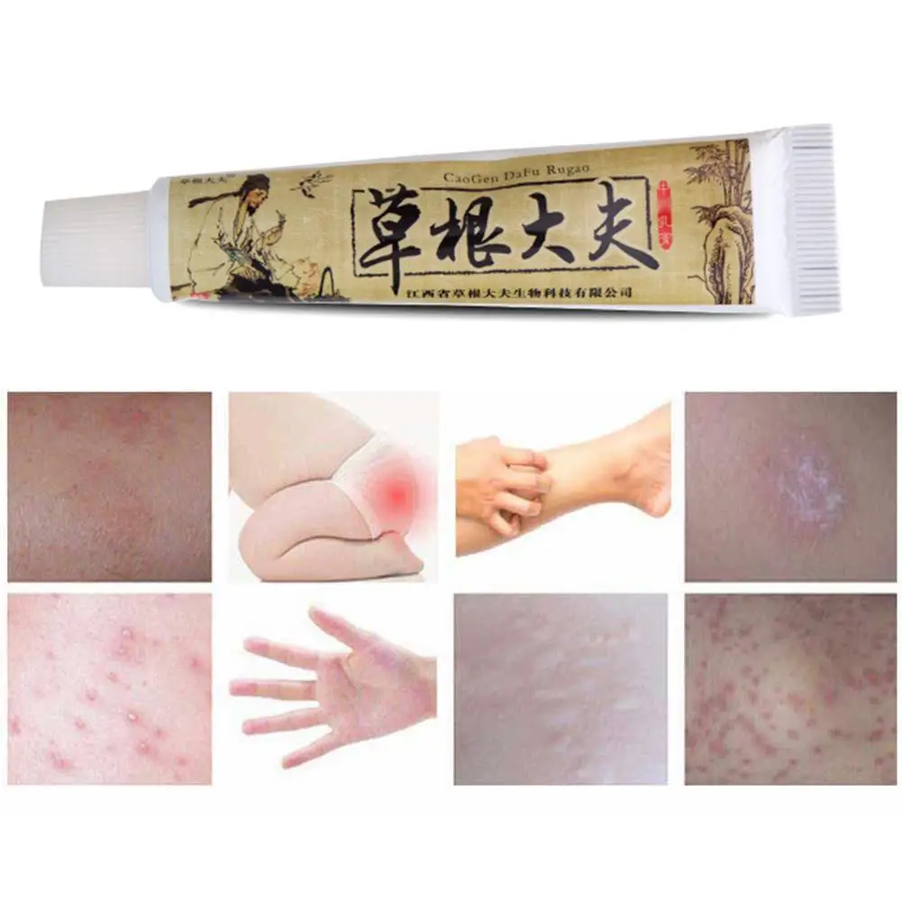 Китайский травяной крем от псориаза кожи зуд рельеф для тела Tinea versicolor Balanitis
