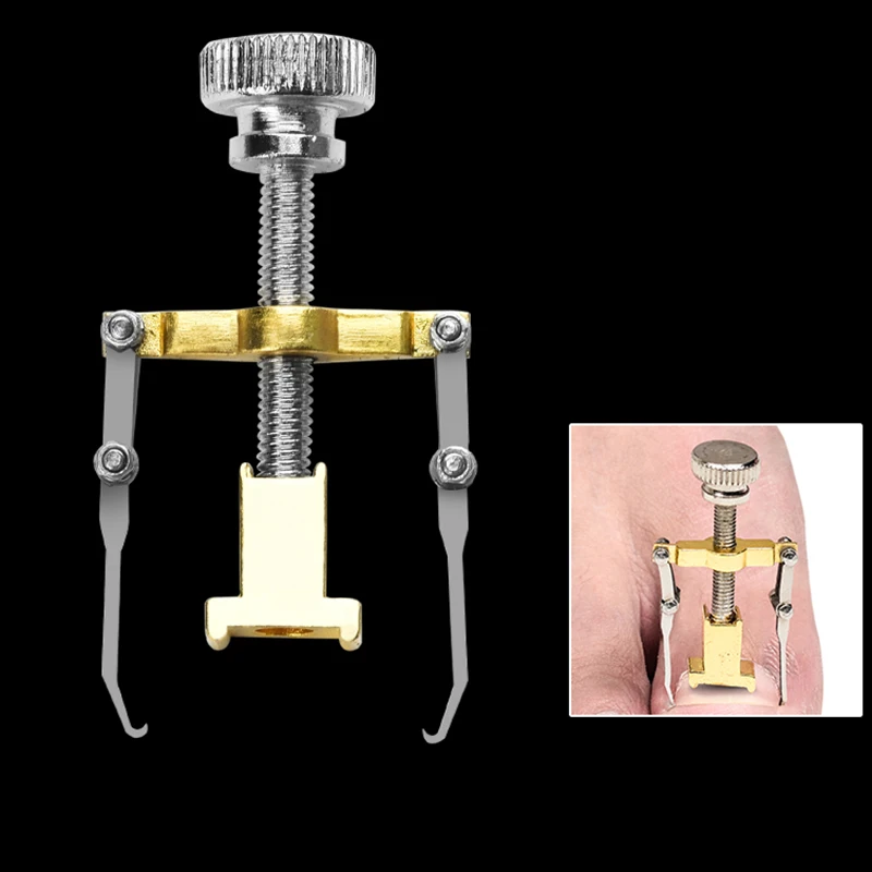 1 шт. вросший носок для коррекции ногтей Педикюр фиксатор выпрямитель клипперы