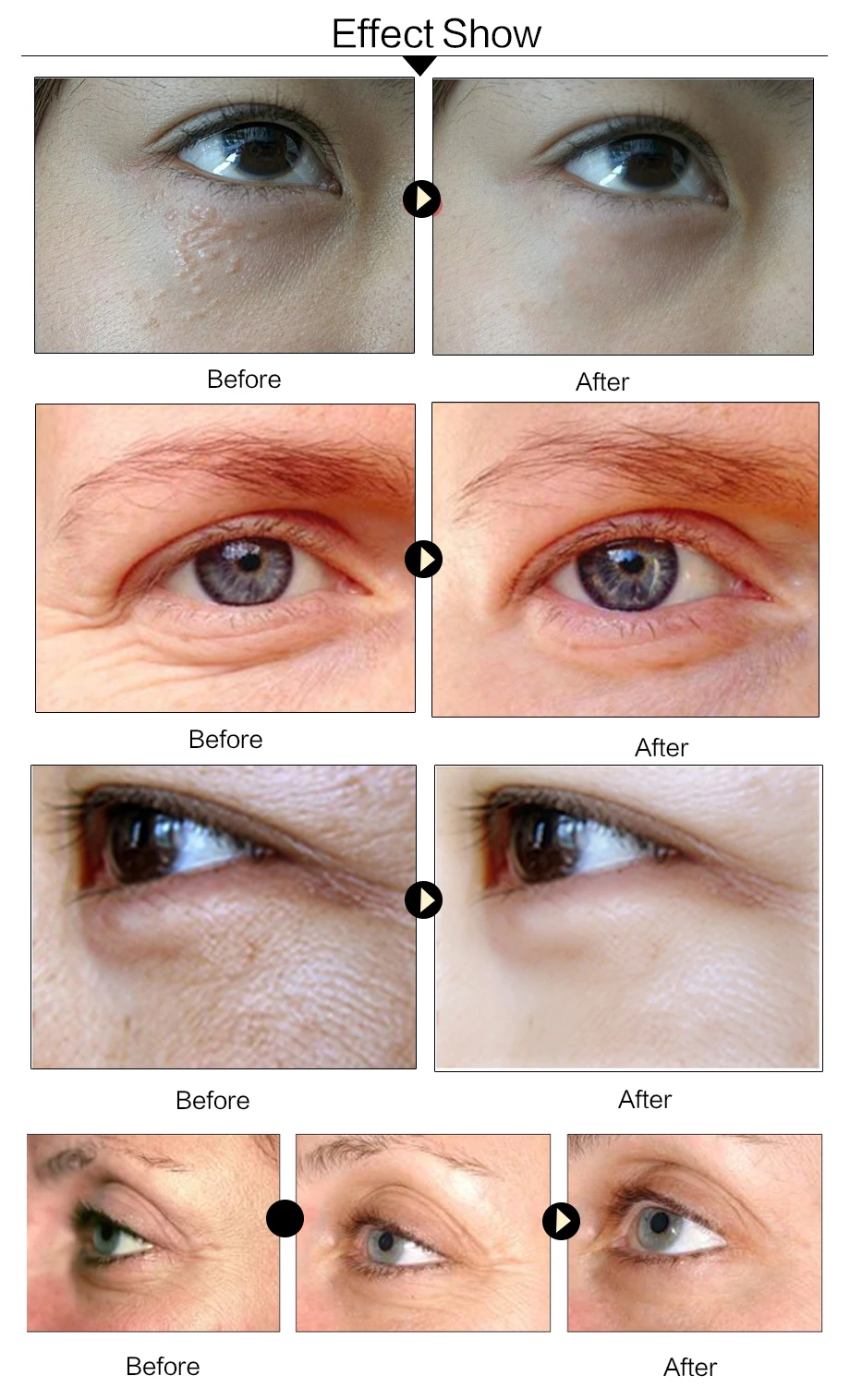 5/8/10/15packs Collagen Eye Mask Anti Aging Anti Puffiness Moisturizing Eye Masks Dark Circles Remover Eye Patches Gel Eye Pads