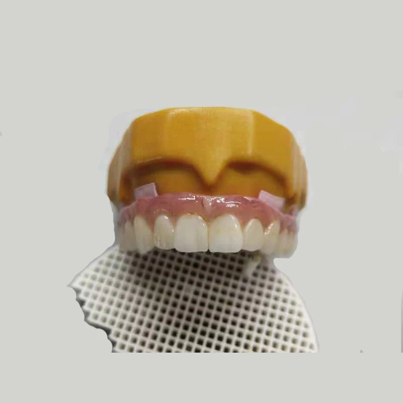 Прозрачная многослойная заготовка из циркония с заготовкой цвета Vita и мостовыми