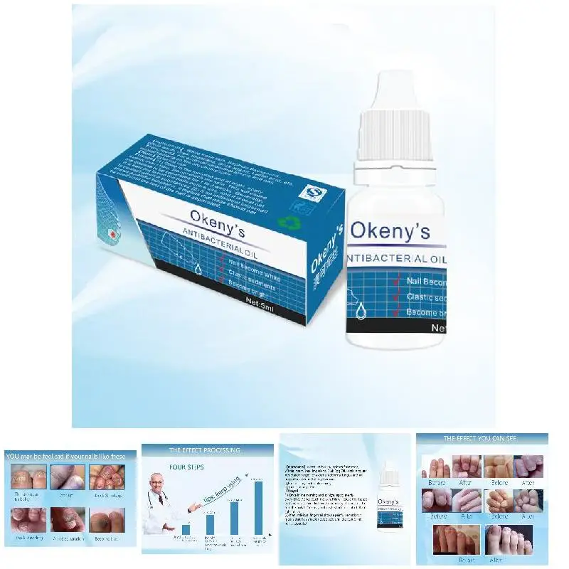 Горячая ногтей антибактериальное масло ремонт питание противогрибковый Яркий