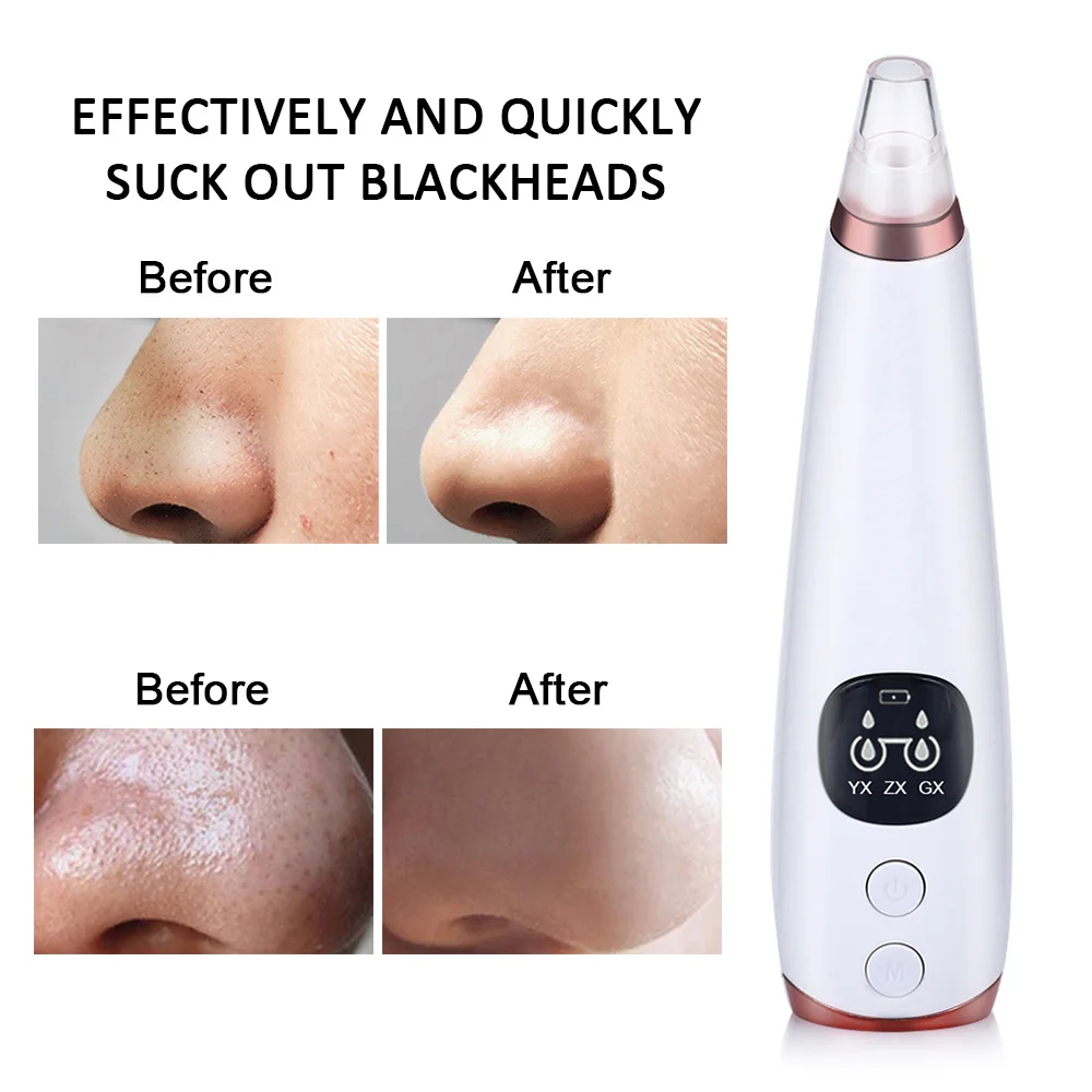 USB Перезаряжаемый прибор для удаления черных точек лица ПОР вакуум уход за кожей