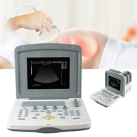 9 7high resolution tft lcd color ultrasound doppler sinohero cost effective high performance 3d ultrasound scanner