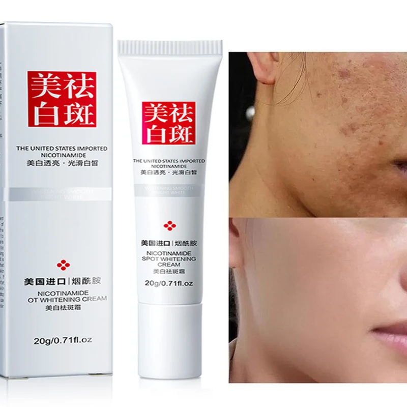 

Freckle Whitening Cream Remove Dark Spots Anti Acne Cream Anti Freckle Discoloration Pigmentation Melasma Glow Skin Care Creams