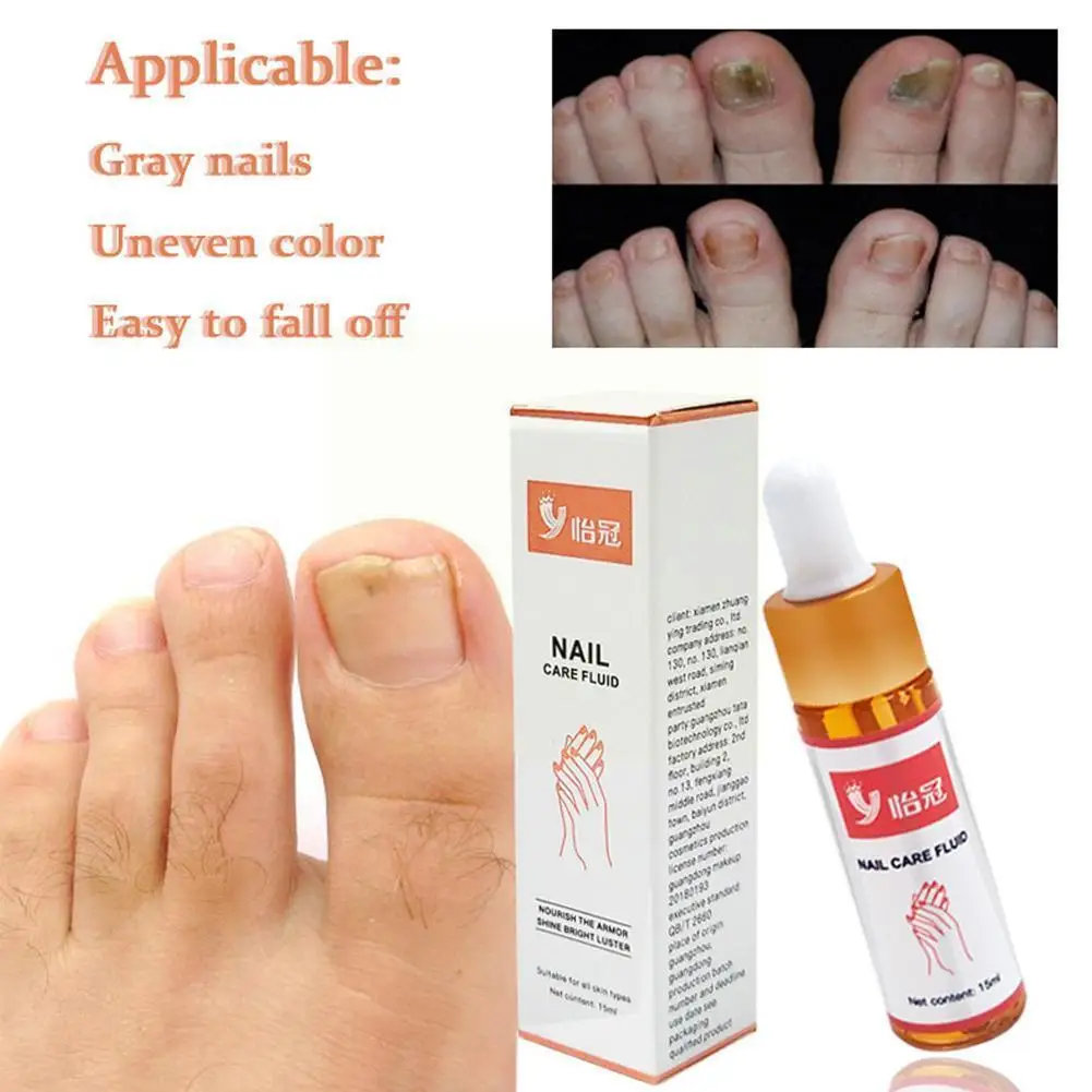 

15ml Fungal Nail Repair Essence Serum Care Treatment Paronychia Nail Care Removal Infection Onychomycosis Foot Anti Fungus X7K3