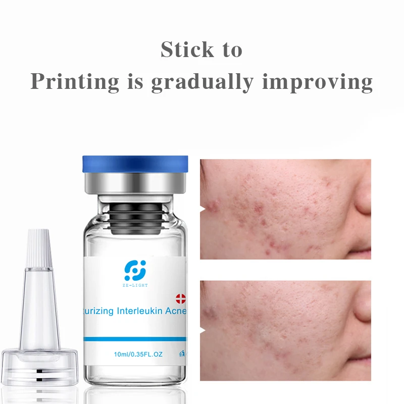 

Natural Extract Derma Roller Serum Mesotherapy Microneedle Dermapen Acne Scar Pimple Treatment Shrink Pores Acne Removal Serum