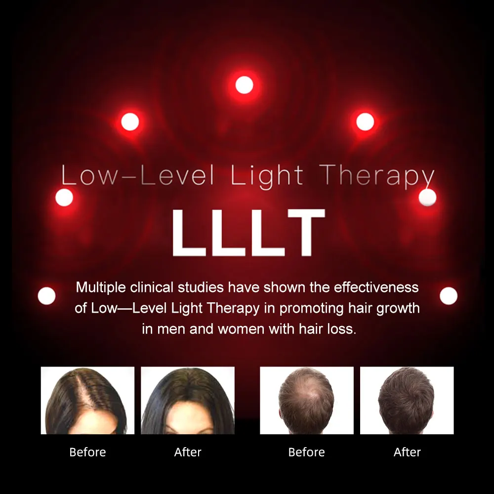 

LESCOLTON Laser Hair Growth Helmet Infrared Cap LED Hat for Hair Growth Hair Loss Treatment Device for Men and Women FDA Cleared
