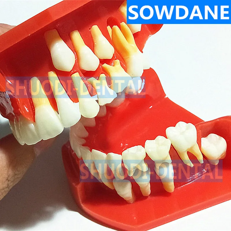 Стоматологическая детская модель выпадающих зубов сменная постоянные зубы