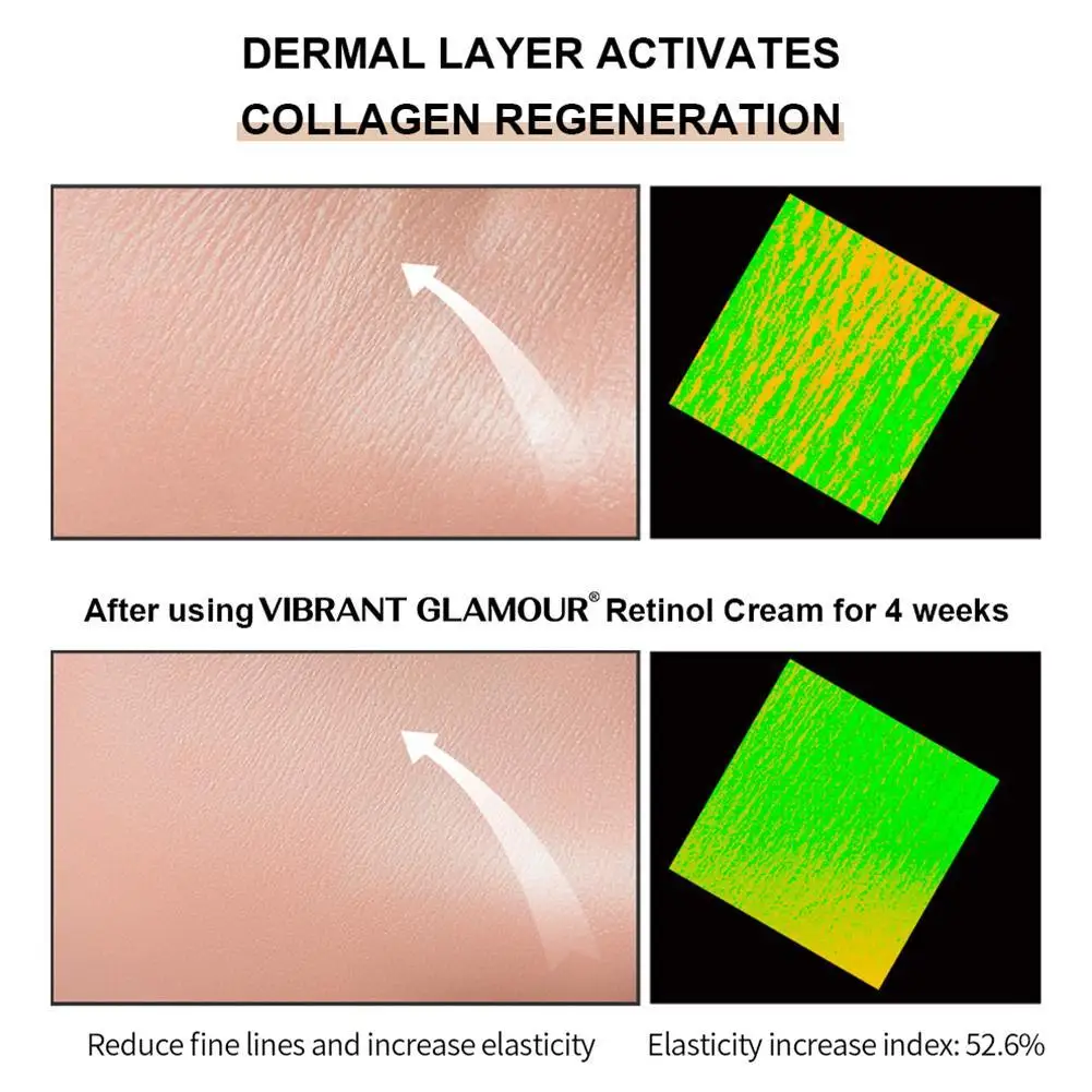 

Eye Cream Removes Dark Circles Reduces Fine Lines Brightens Creams Skin Moisturize Anti Remover Aging Wrinkle For Skin Whit D8V4