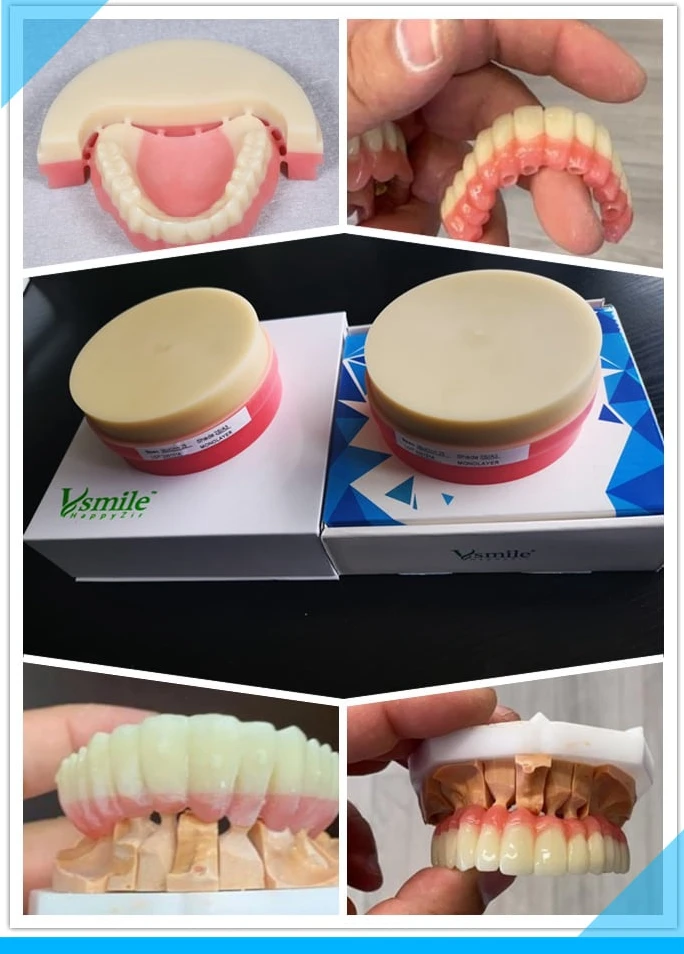 Double Layer Monolithic Dental Milling PMMA Disc Biocompatible Acrylic Hybrid Blanks For Dental Lab Temporary Denture Crown 10cans bag dental denture flexible acrylic with blood streak for flexible partial denture