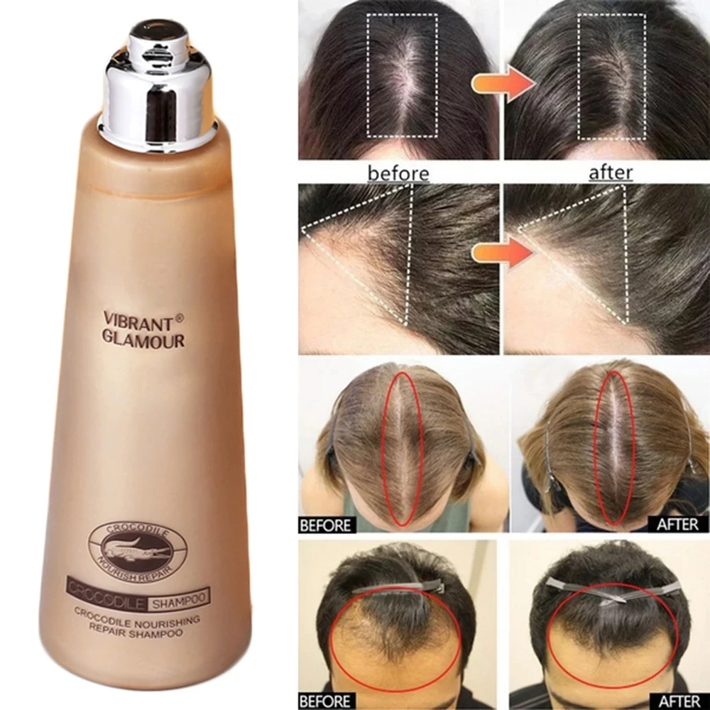 200ml Crocodile Hair Growth Shampoo Anti Hair Loss Treatment Fast Growth Longer thicker for Men Women Best Hair Growth Products