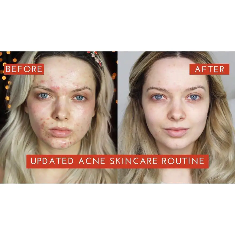 Тоник для лица Pixi Skintreats 5% тоник с гликолевой кислотой сыворотка против старения